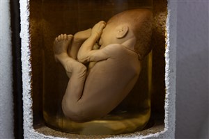 Image description is not available for 1983.70.1